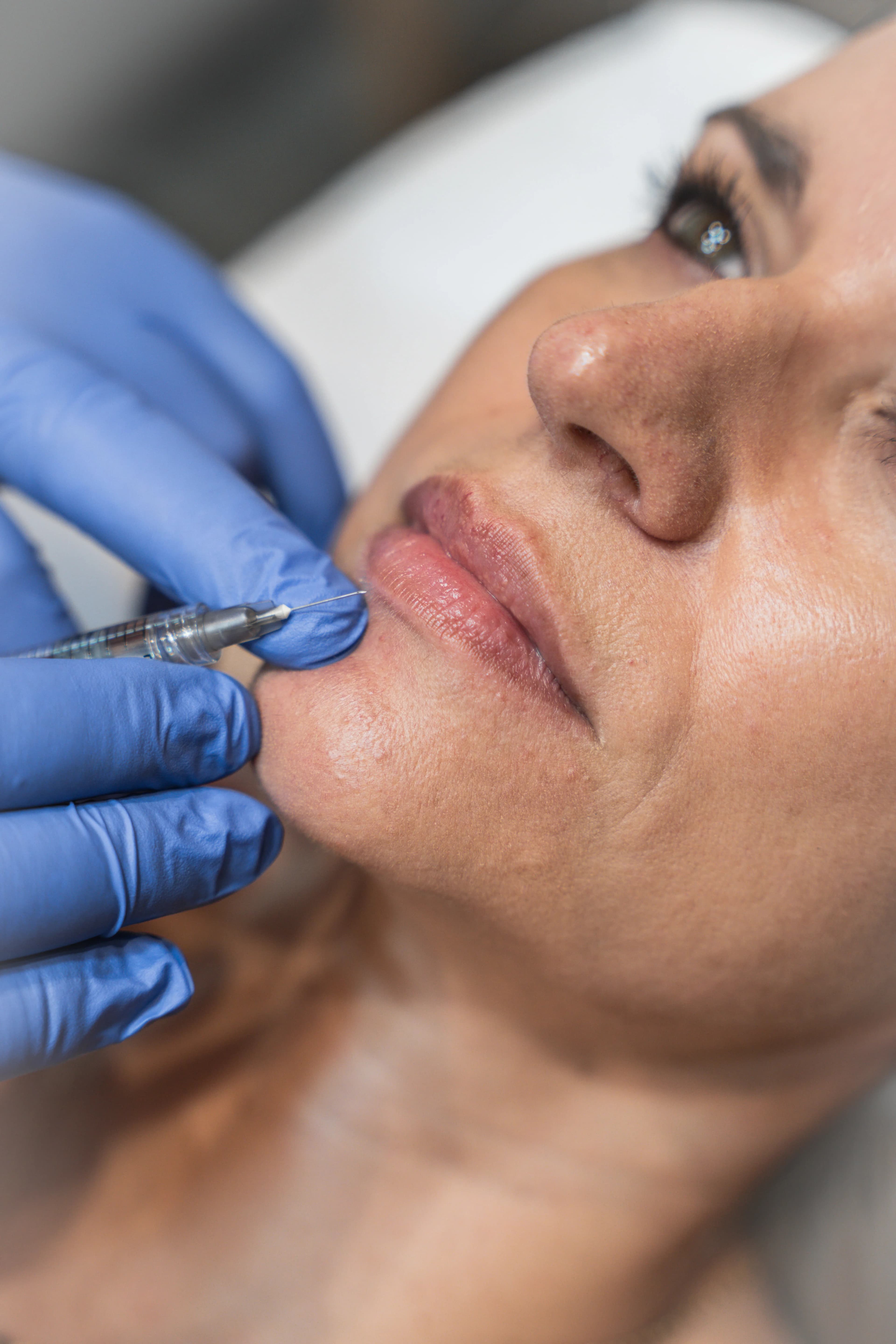 Servicios Medicina Estética
