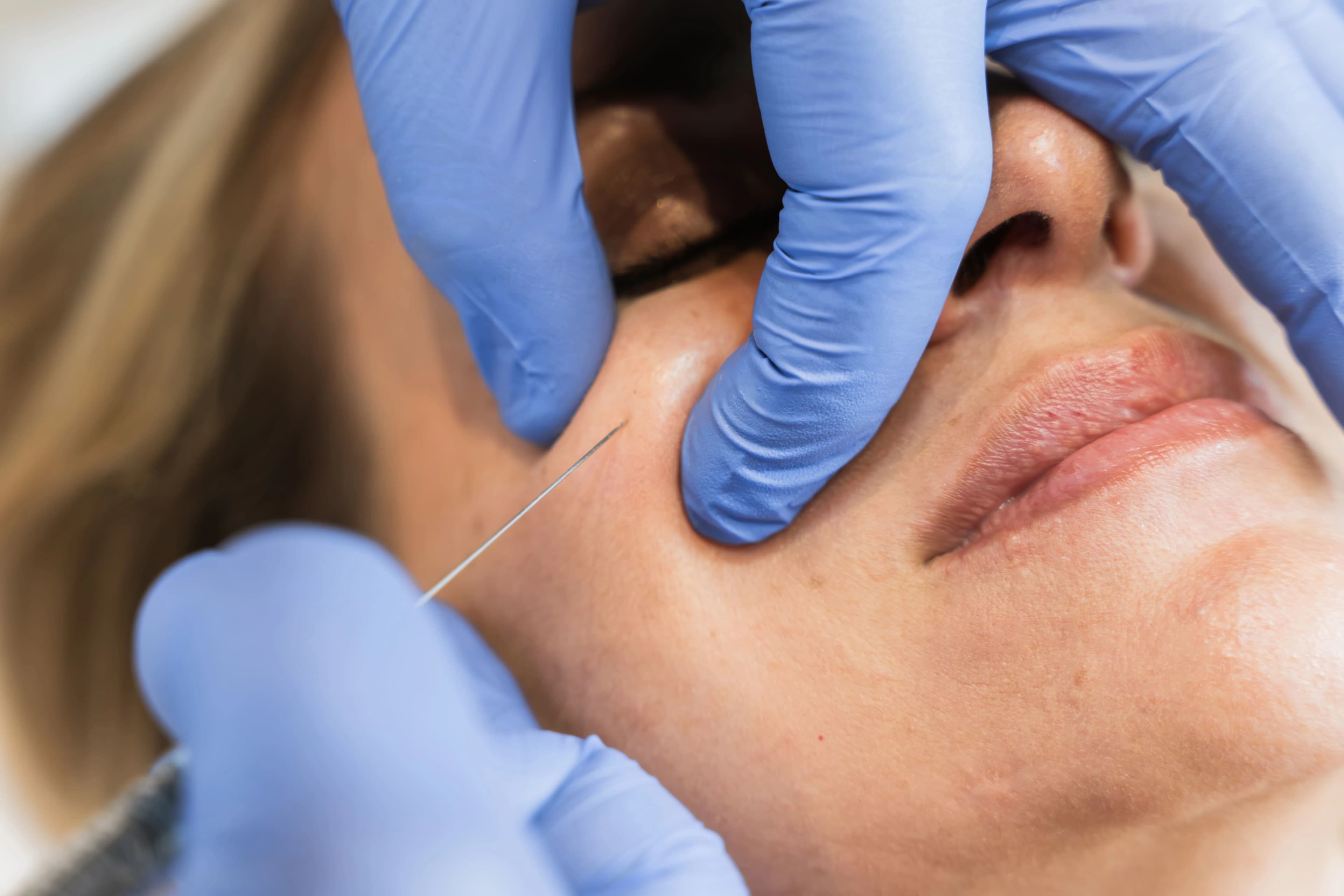 Tratamiento facial en Clínica Hera